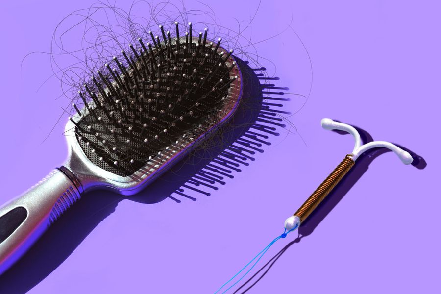 Can-Birth-Control-Cause-Hair-Loss-GettyImages-1339104935-1174855113